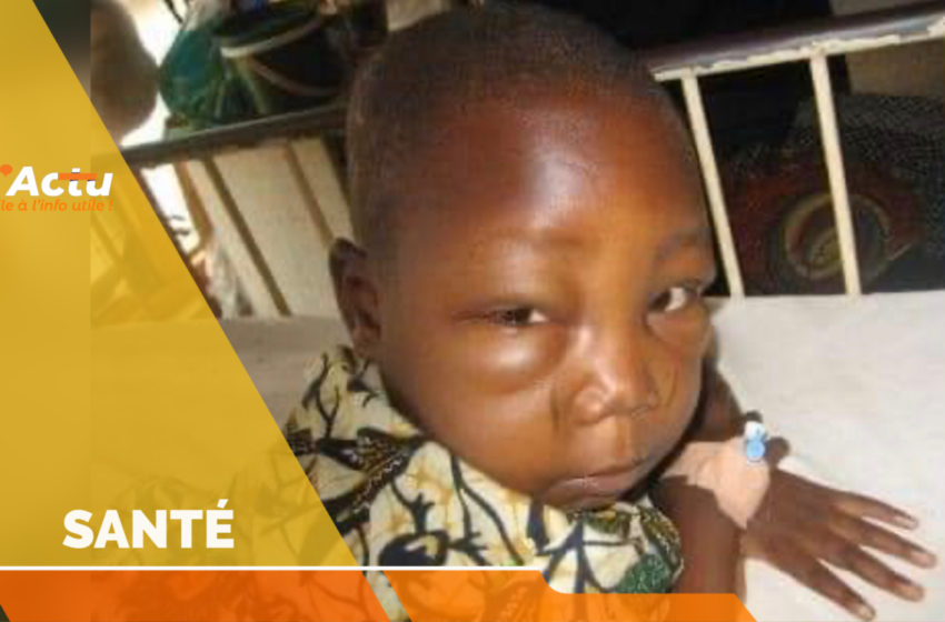  Glomérulonéphrite aiguë, une maladie qui touche des enfants haïtiens depuis deux mois