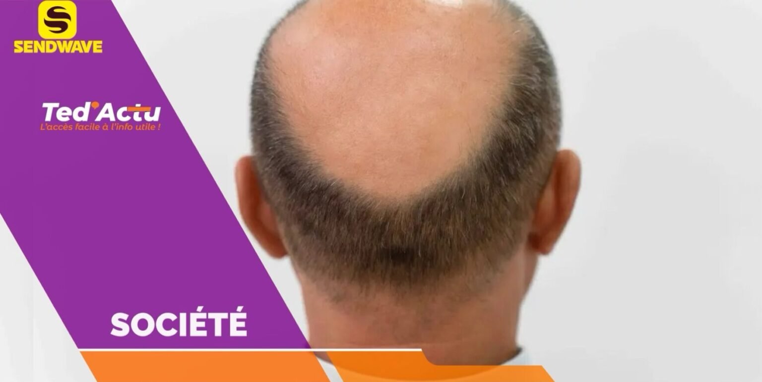 Kèk avantaj ki genyen lè w chòv